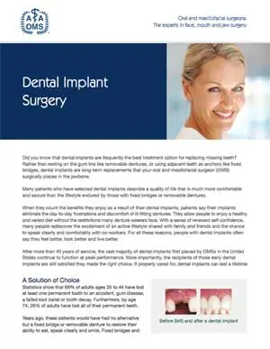 AAOMS Ebook on Dental Implants
